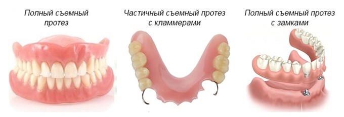 Съёмное протезирование зубов