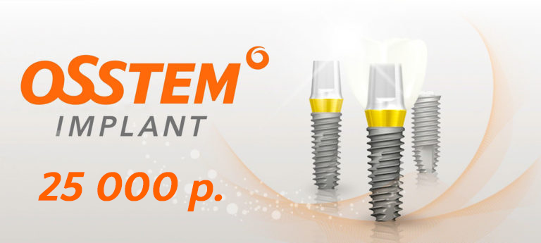 Импланты Osstem